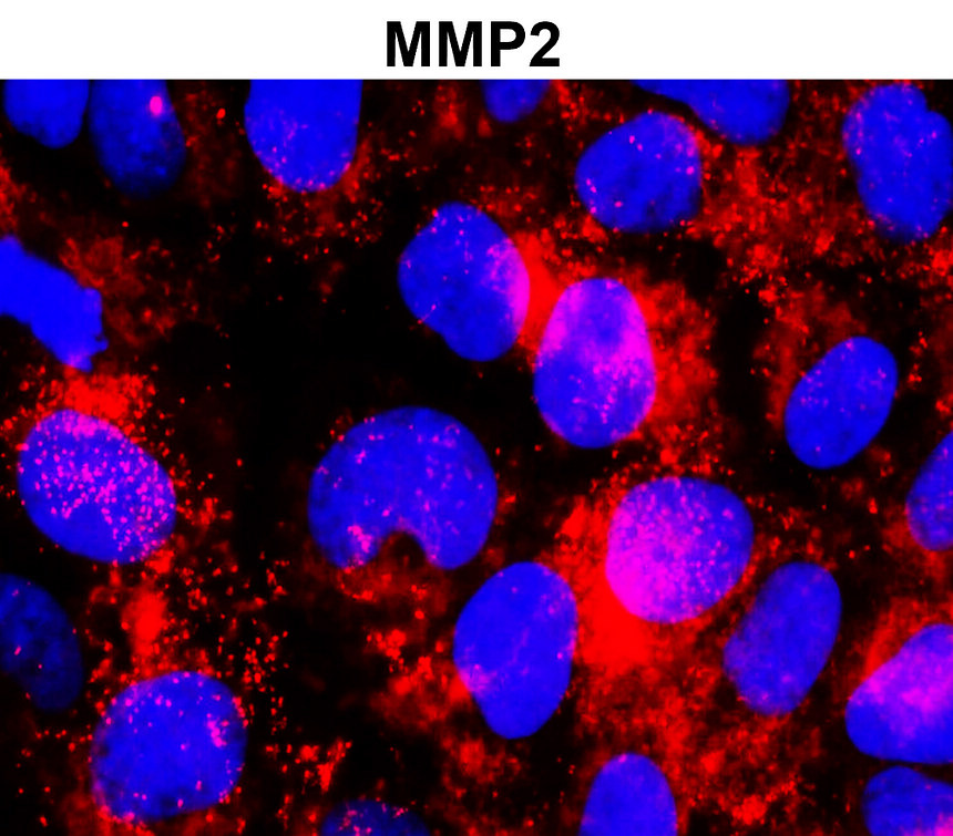 IR67-228 anti- MMP2 antibody [c-term] ICC/IF image