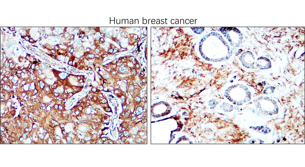 IRCP220601 anti-IGLC2 antibody IHC image