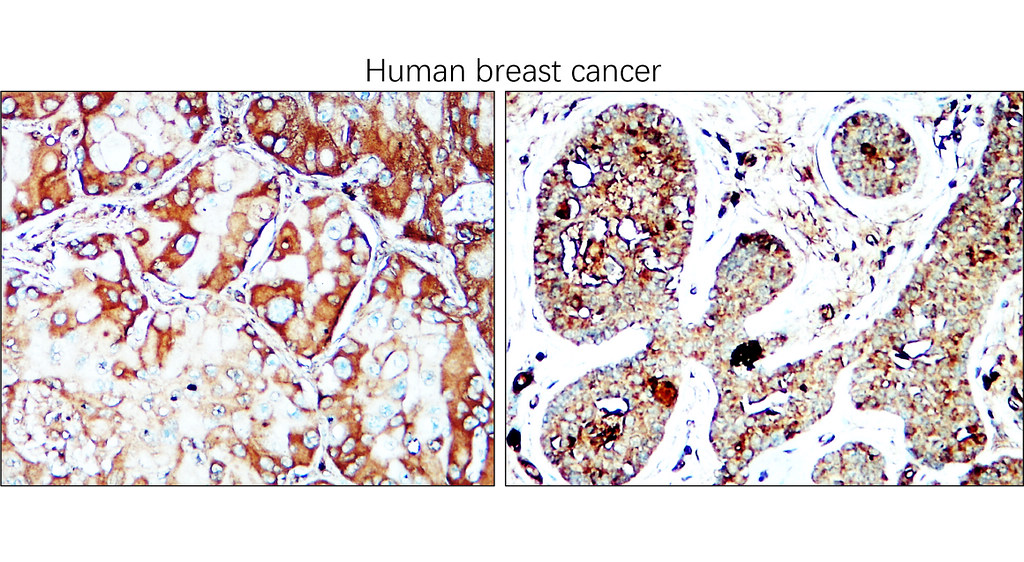 IRCP220601 anti-IGLC2 antibody IHC image