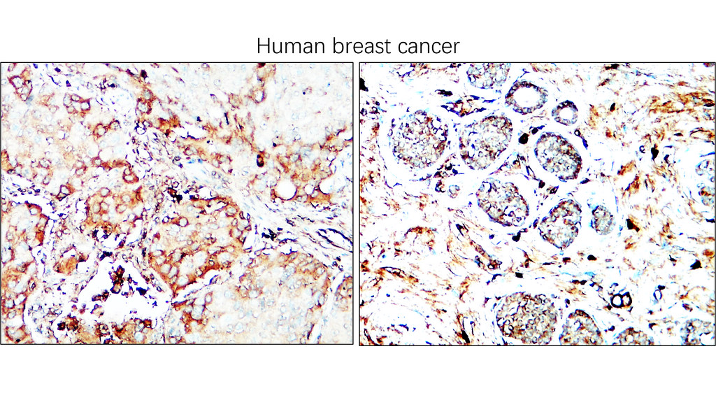 IRCP220602 anti-IGLC2 antibody IHC image