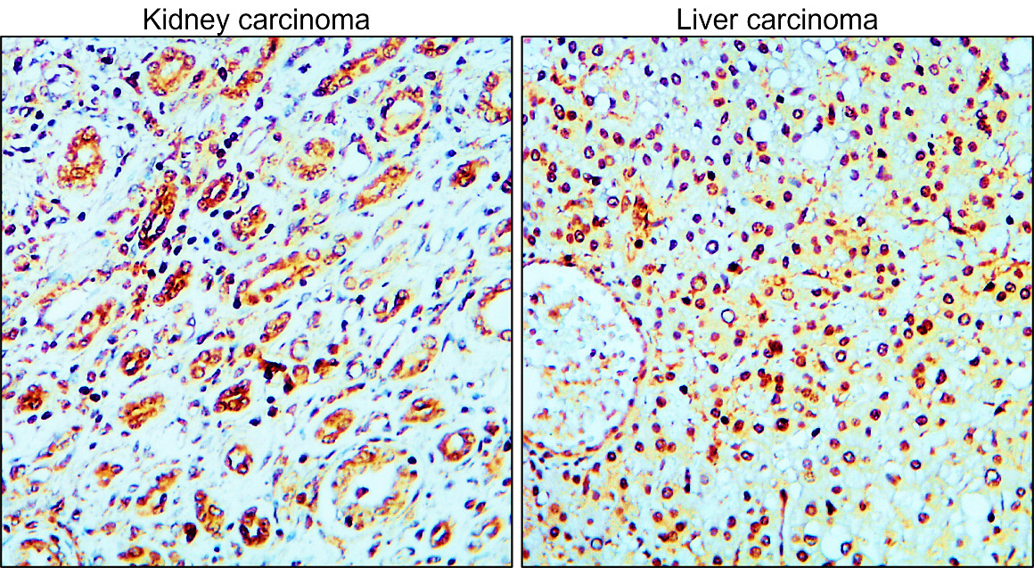 IR219-807 anti c-MET antibody IHC image