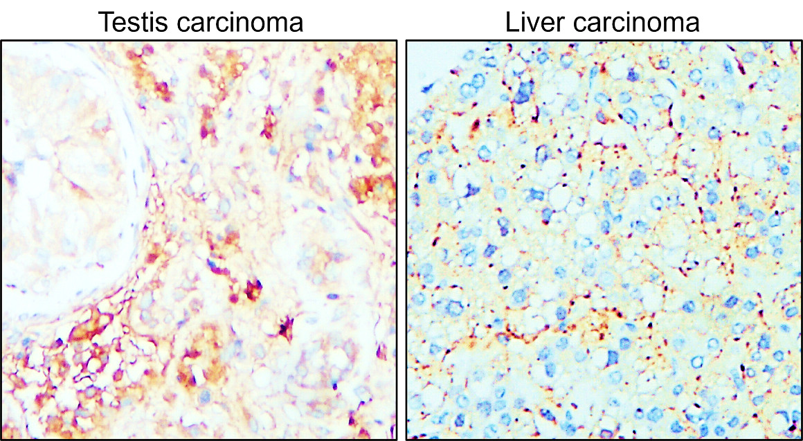 IR71-245 anti-MMP14 / MT1-MMP antibody IHC image