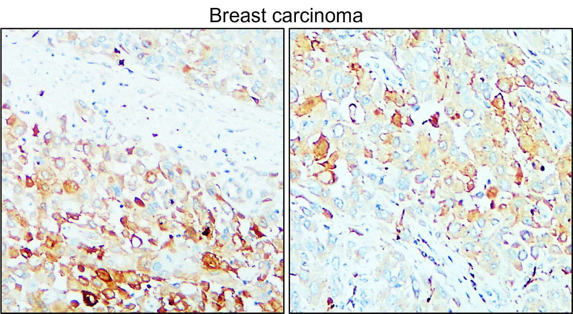 IR71-245 anti-MMP14 / MT1-MMP antibody IHC image