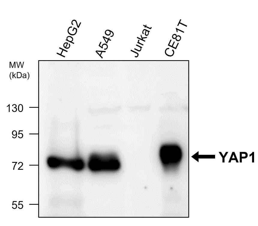 IR290-956 anti-YAP1 antibody WB image