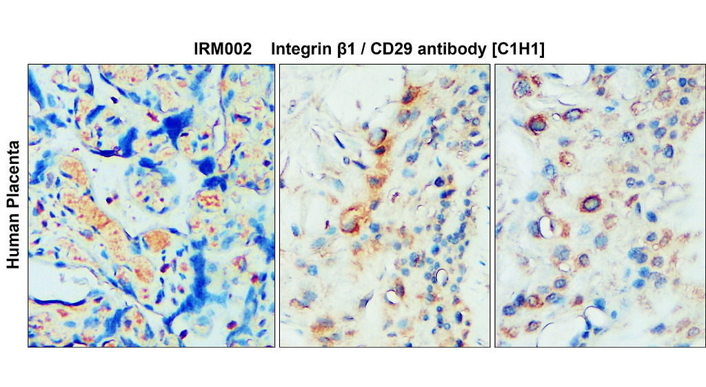IRM202 Integrin β1 / CD29 antibody [C1H1] IHC image