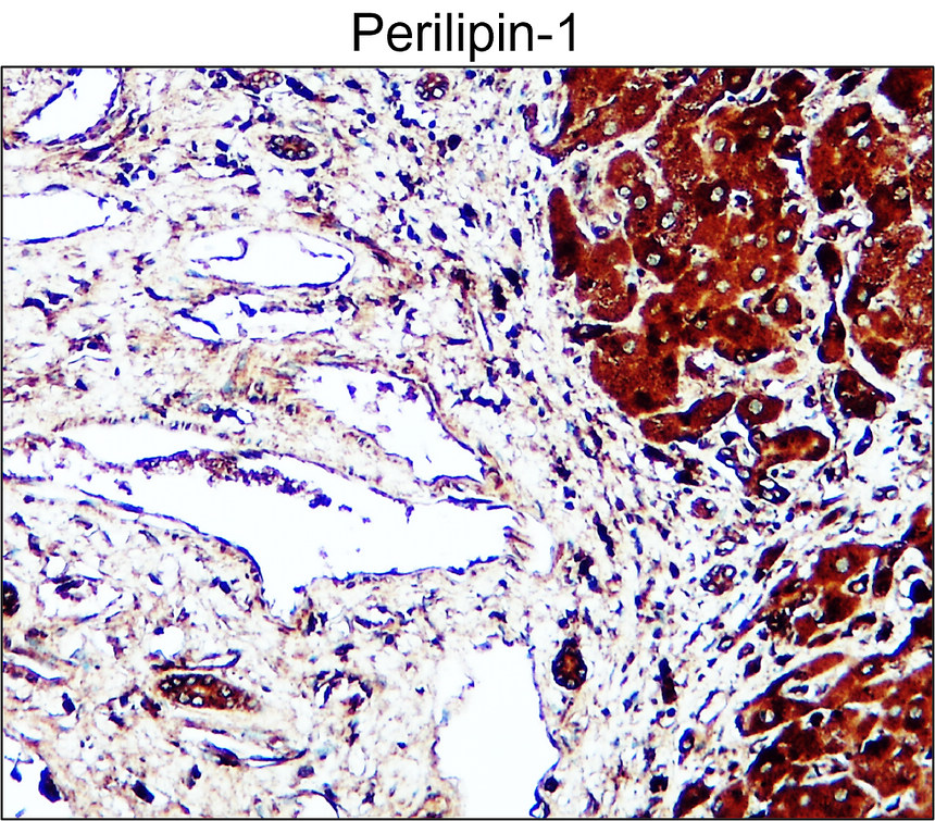 IR343-927 anti-Perilipin-1 antibody IHC image