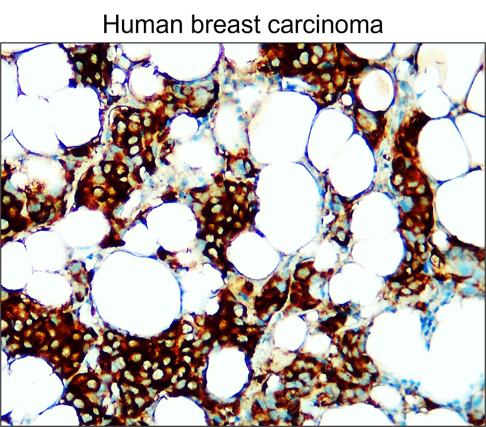 IR342-925 anti-Fatty Acid Synthase antibody IHC image