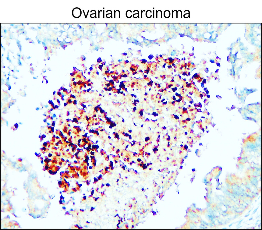 IR344-930 anti-PPARγ antibody IHC image