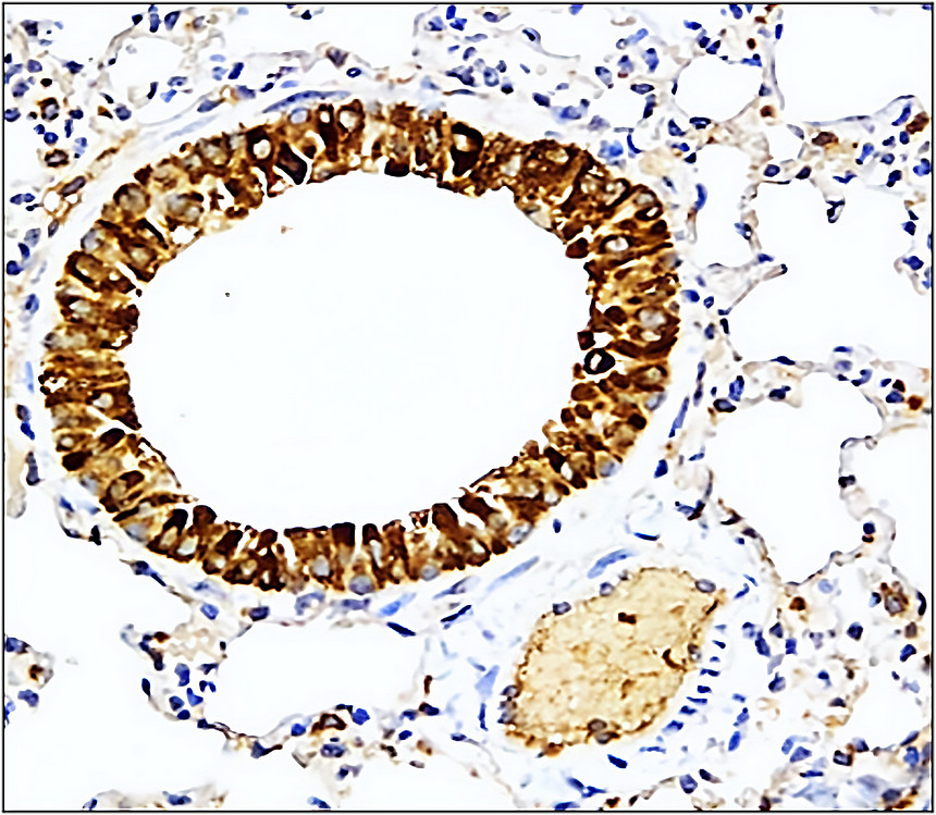 IR114-473 anti-IL1 beta antibody IHC image