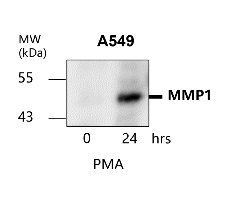 IR66-225 anti-MMP1 antibody WB image