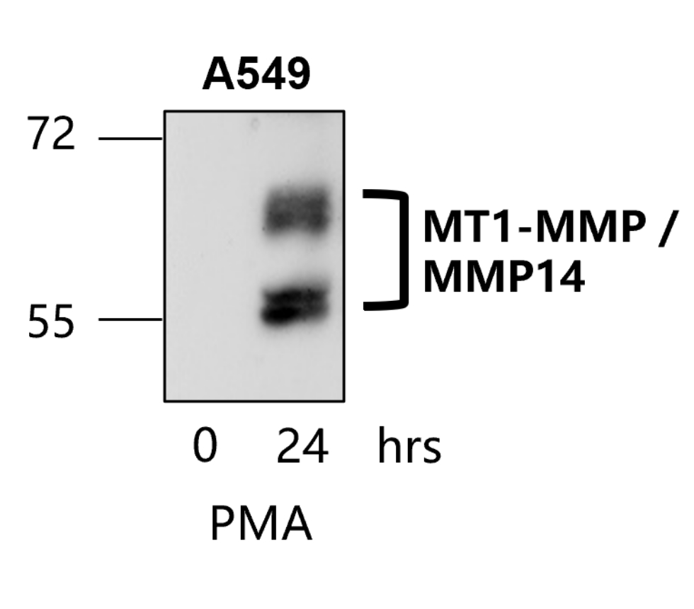 IR71-245 anti-MMP14 / MT1-MMP antibody WB image