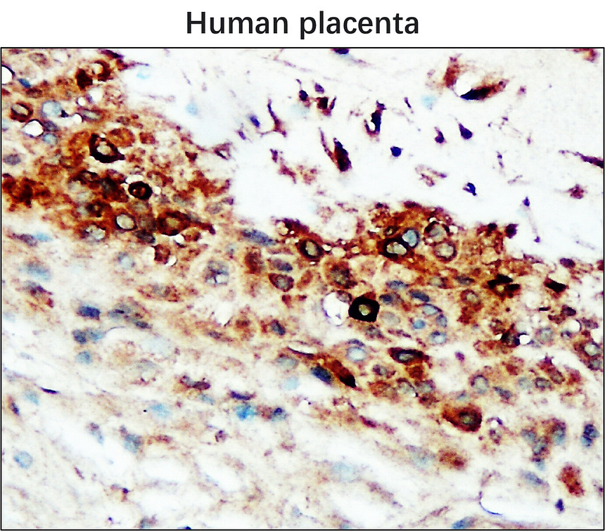 IR67-228 anti- MMP2 antibody [c-term] IHC image