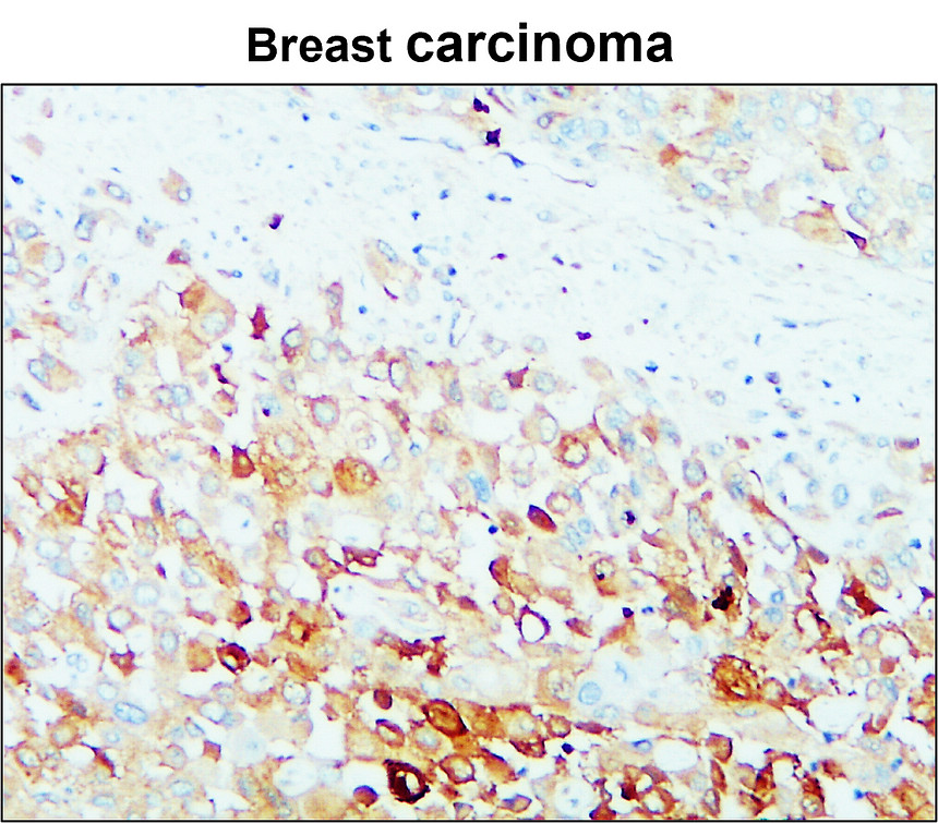 IR71-245 anti-MMP14 / MT1-MMP antibody IHC image