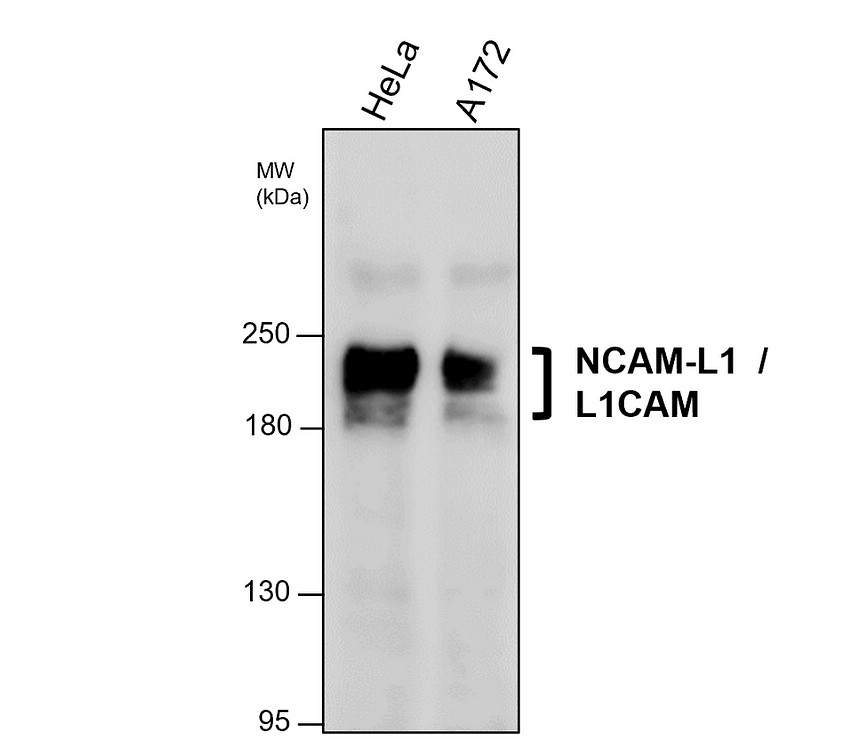 IRM014 NCAM-L1 / L1CAM monoclonal antibody [23B] WB  image