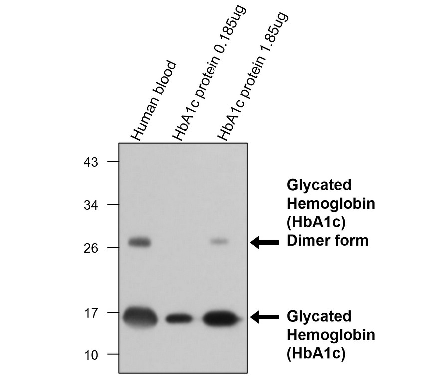 IRM015 HbA1c monoclonal antibody [23C] WB image