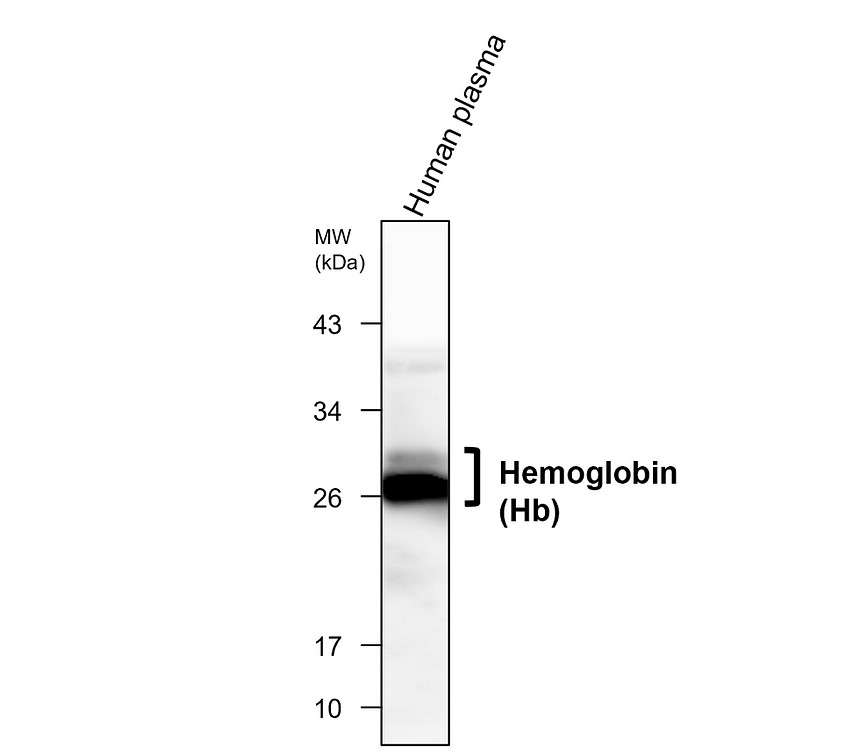 IRM016 Hemoglobin (Hb) monoclonal antibody [23D]  WB image 