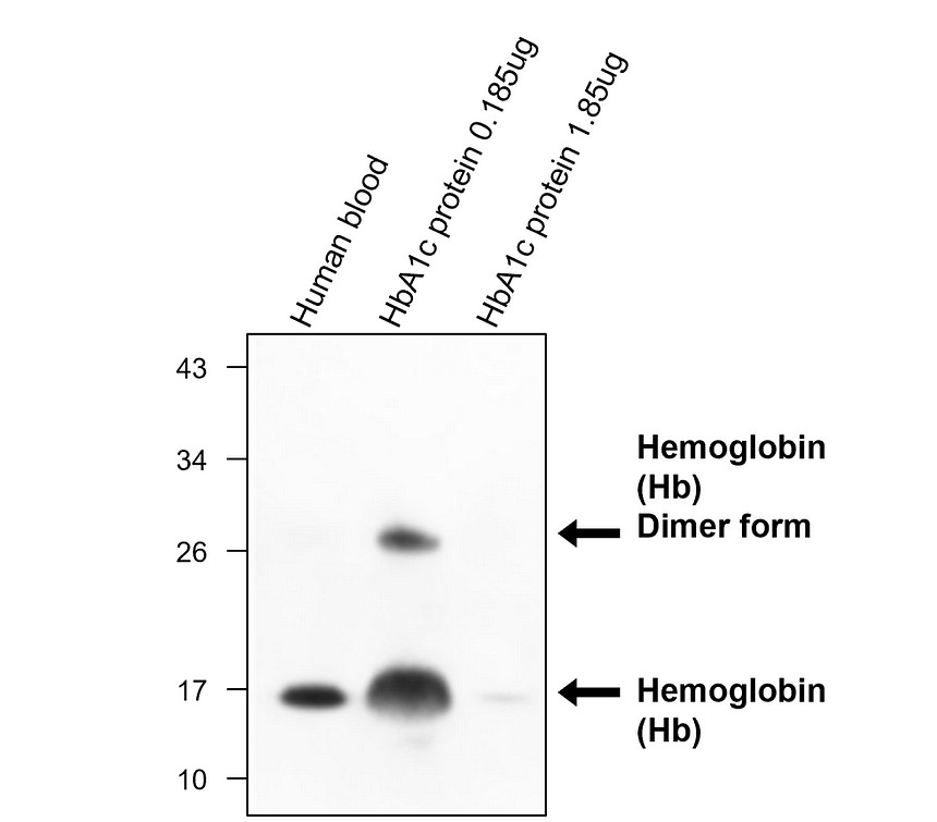 IRM016 Hemoglobin (Hb) monoclonal antibody [23D]  WB image 