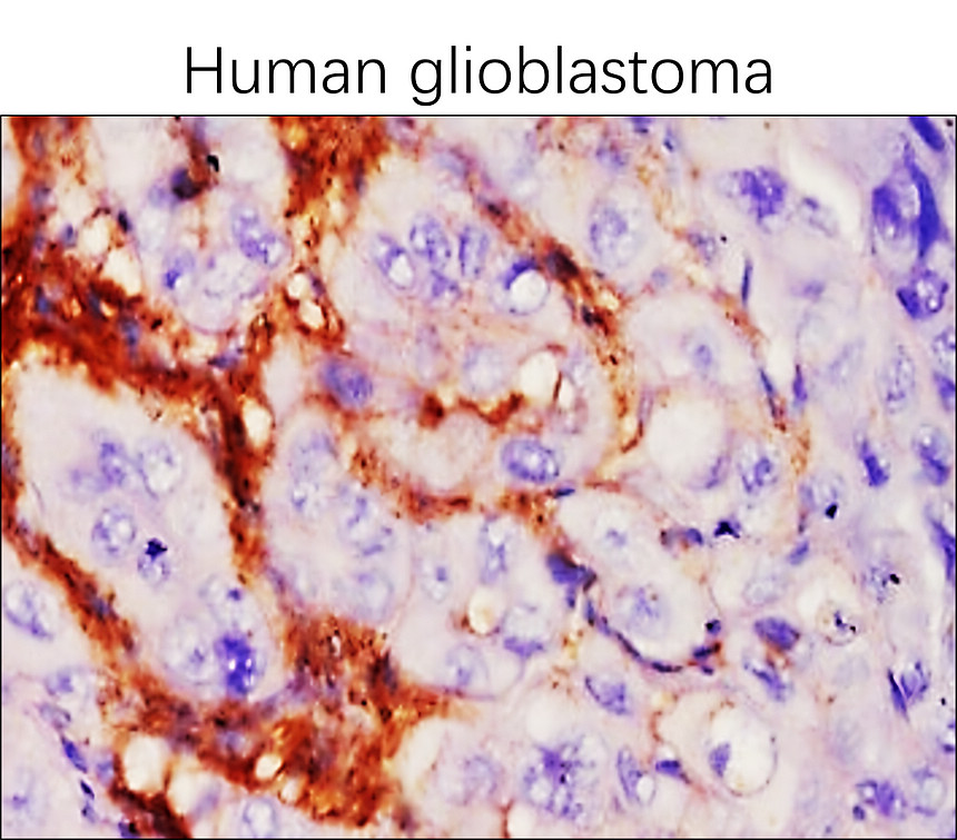 IRM020 EGFR vIII antibody monoclonal antibody  [23H] IHC image