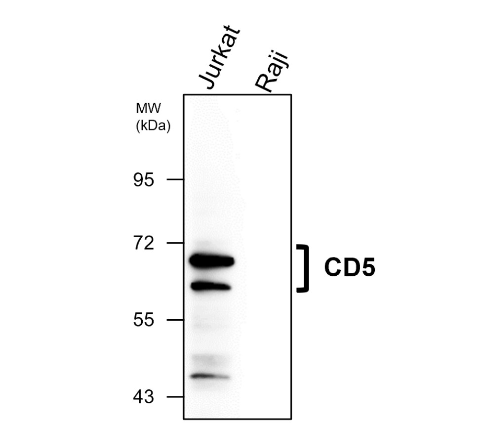 IRM306 CD5 antibody [PG-6] WB image