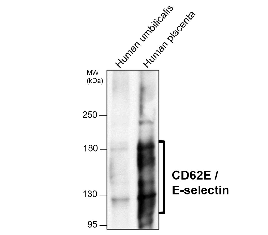 IRM307 CD62E / E-selectin antibody [PH-7] WB image 