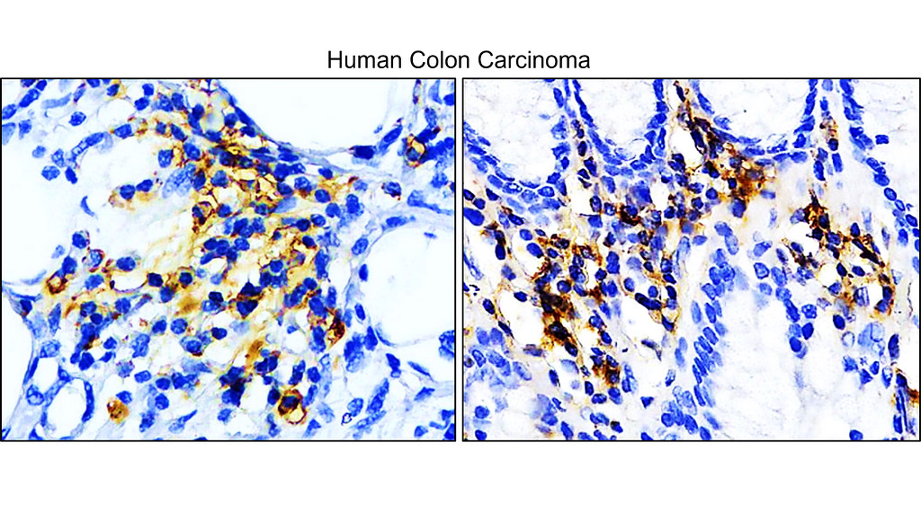 IR167-645 anti-PD-L1 antibody IHC image