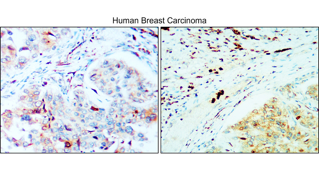 IR167-645 anti-PD-L1 antibody IHC image