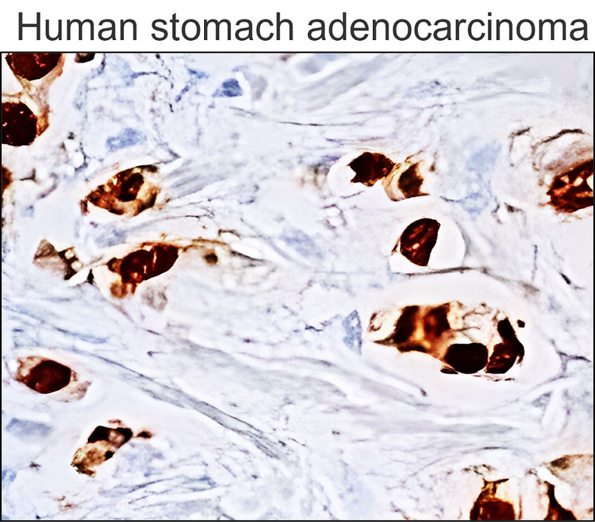 IRM021 p53 monoclonal antibody  [DO-1] IHC image 