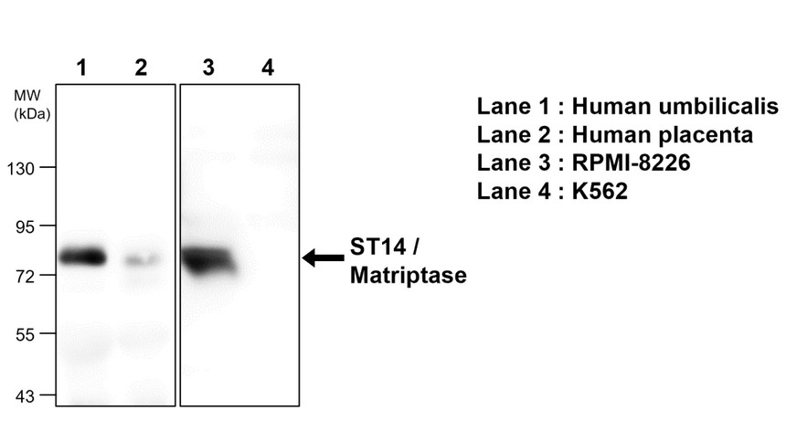 IRM213 ST14 / Matriptase antibody [M32] WB  image 