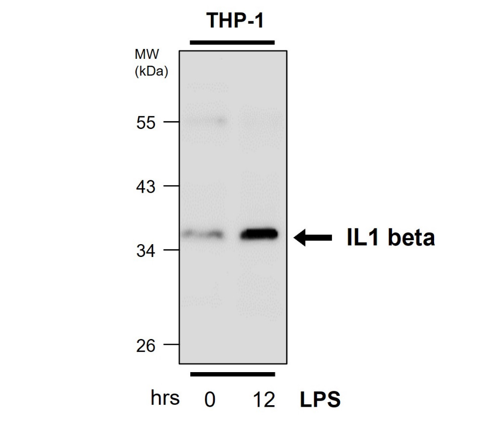 IRM321 IL1 beta antibody [MD5] WB Image