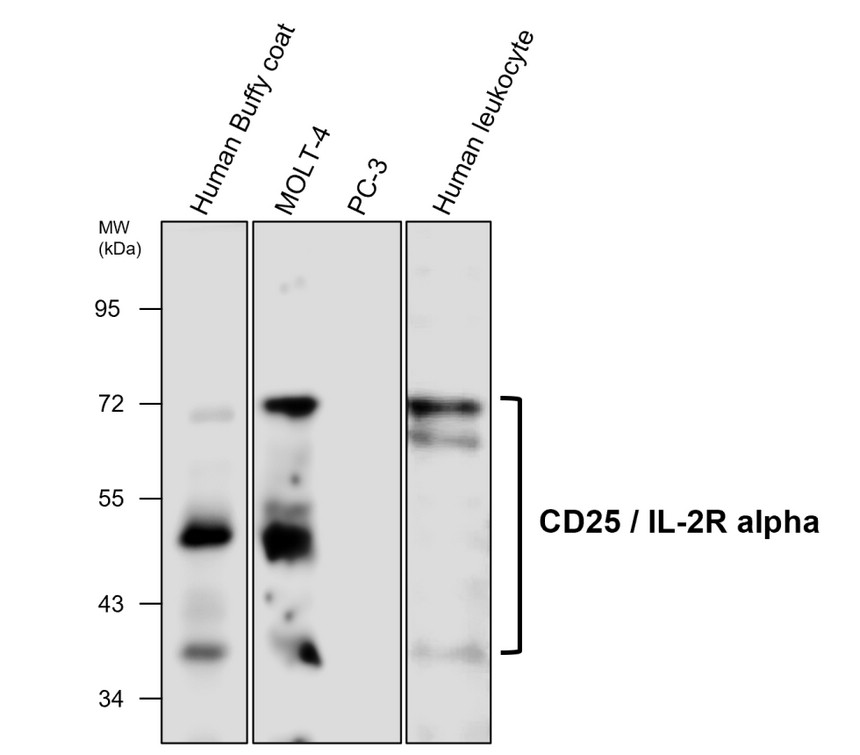 IRM316 CD25 / IL-2R alpha antibody  [M431] WB Image 