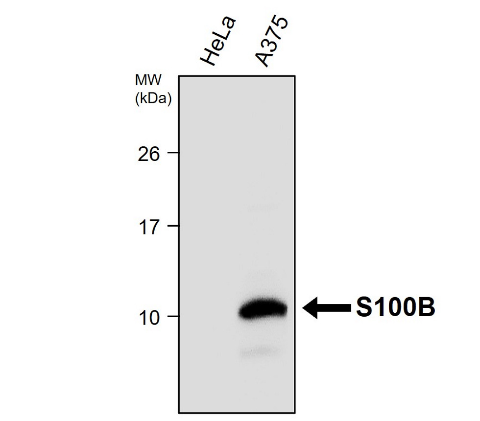 IR27-69 anti-S100B antibody WB image 