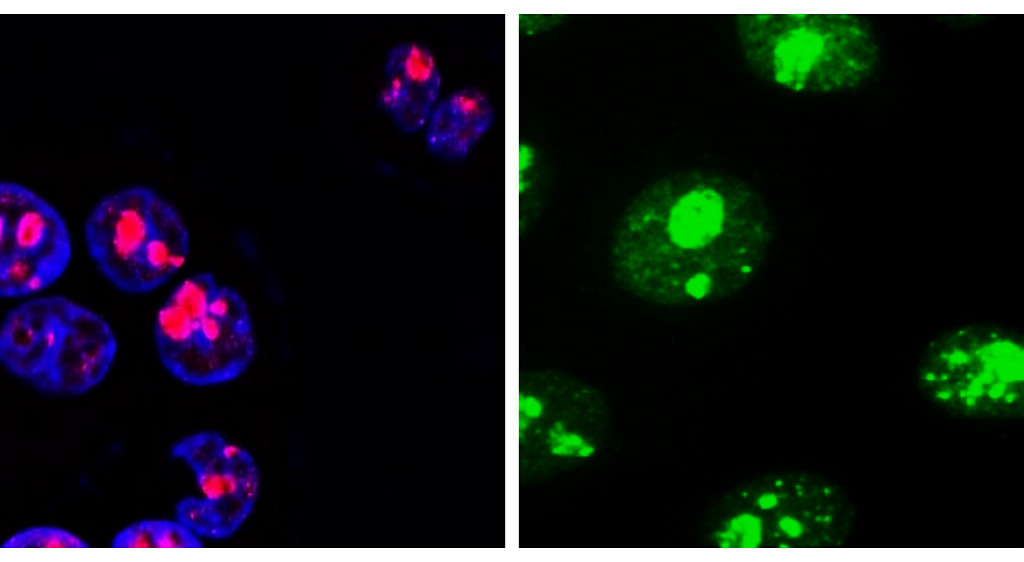 IR212-1 Ki-67 antibody ICC/IF image