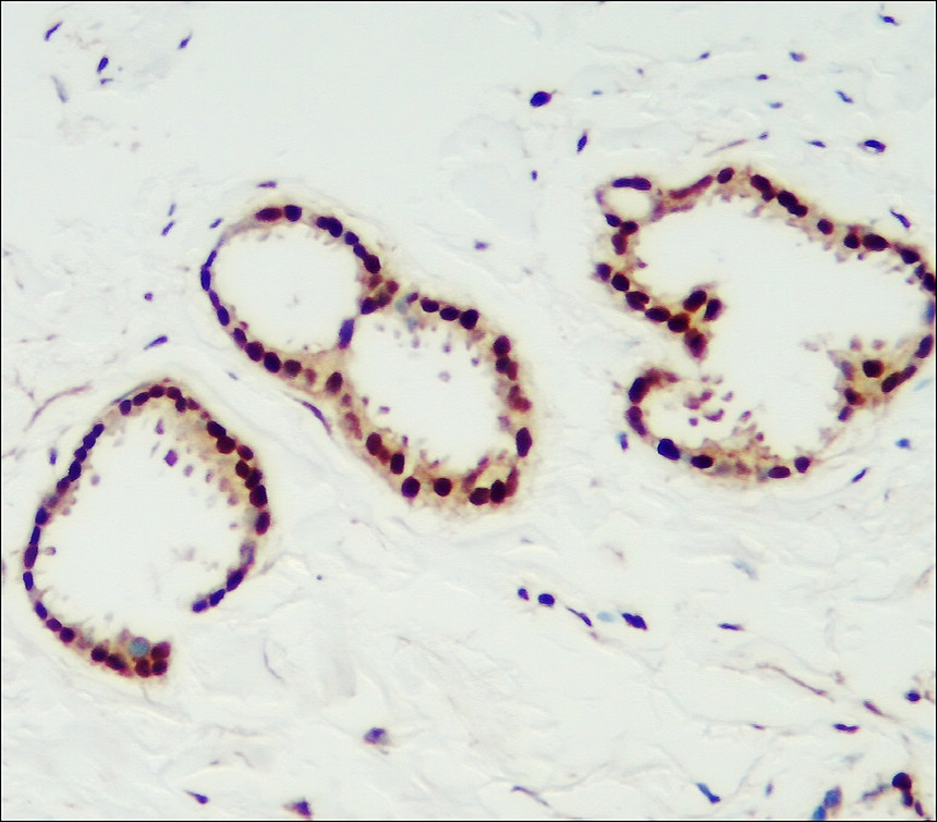 Progesterone Receptor antibody