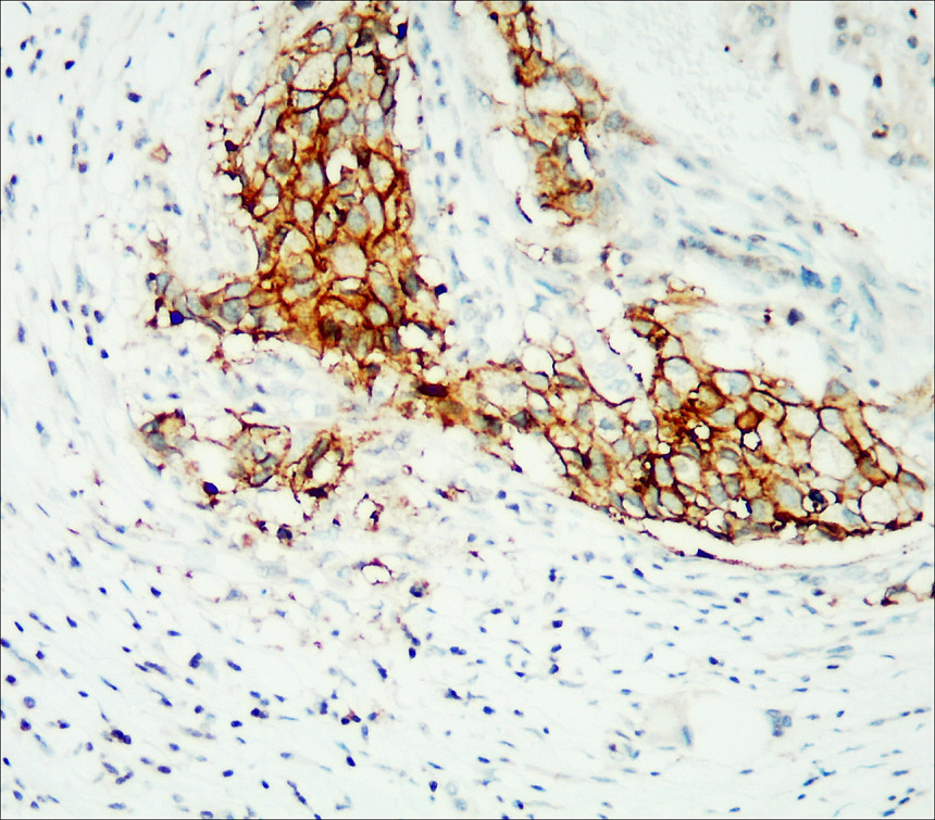 HER2 / ERBB2 antibody