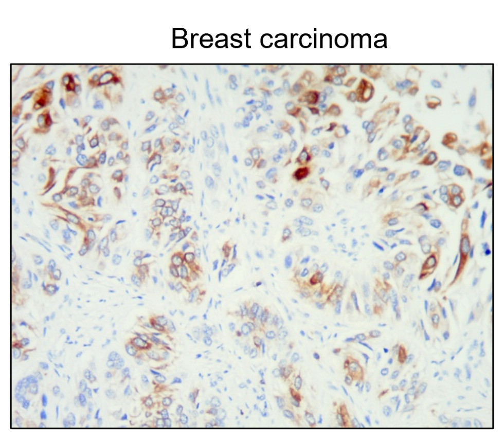 Cytokeratin 20 / CK20 antibody