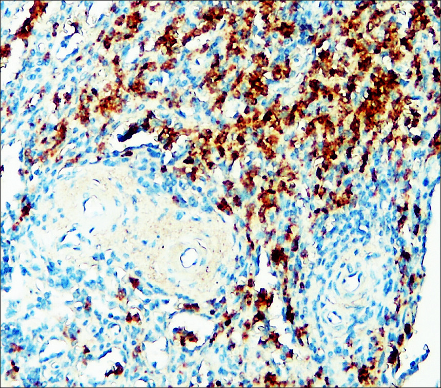 Toll-like Receptor 9 antibody