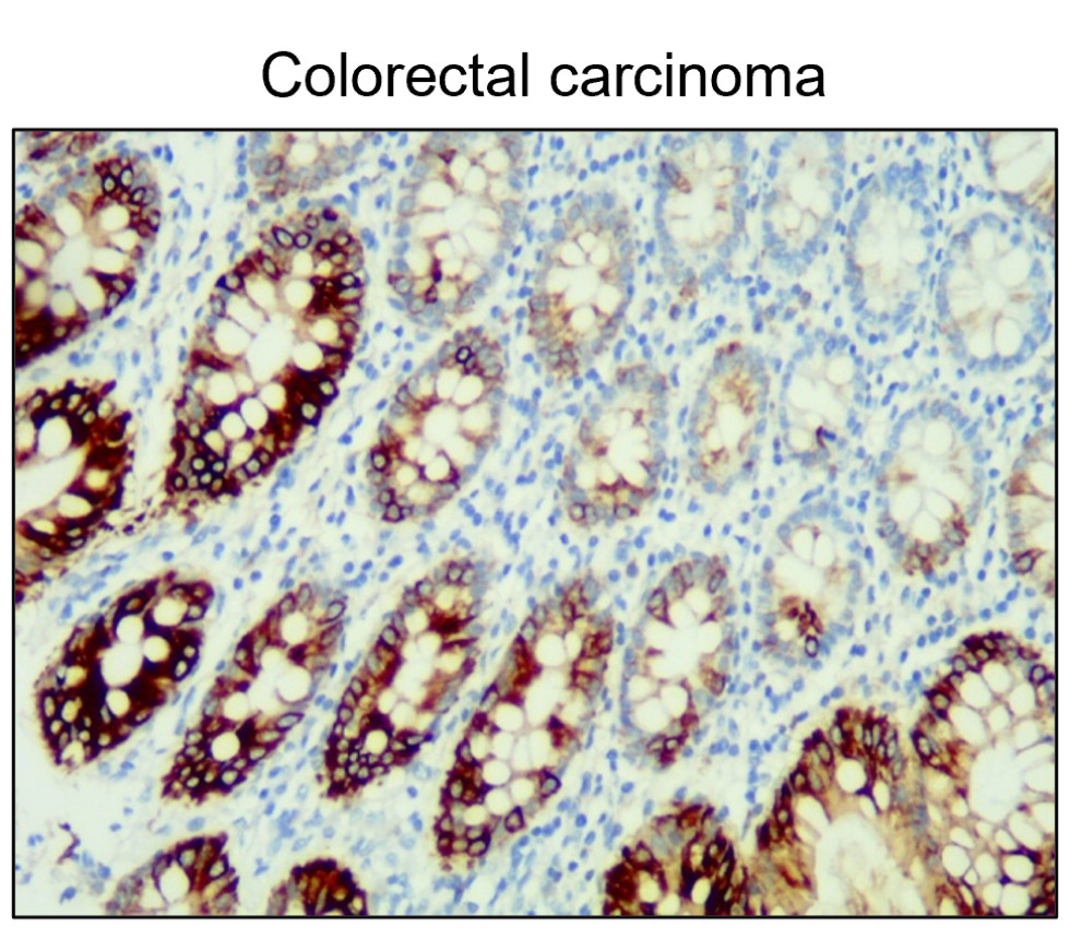 Cytokeratin 20 / CK20 antibody