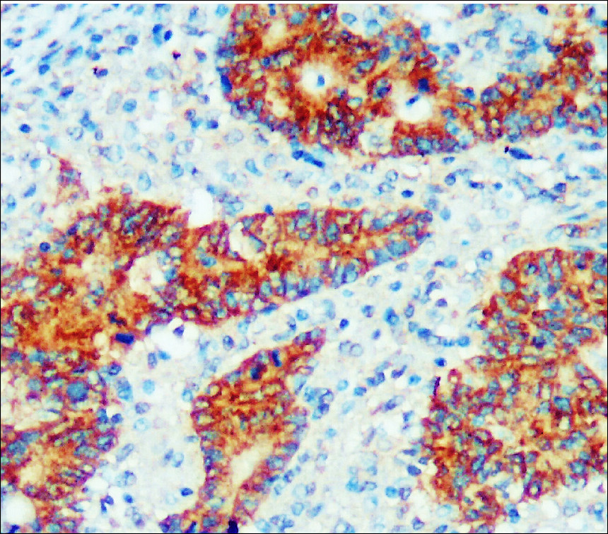 EpCAM antibody 