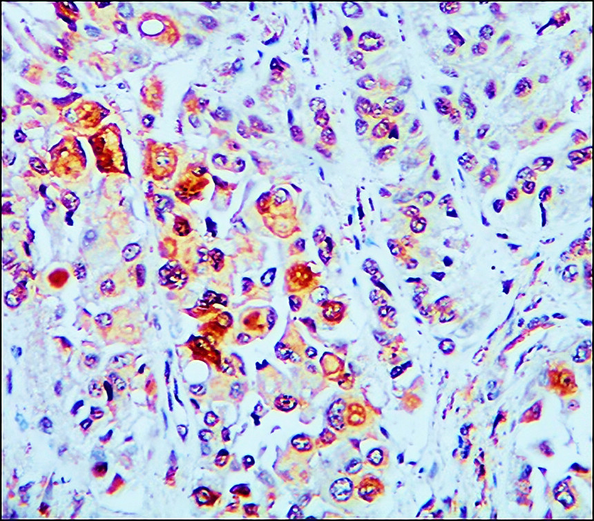 c-MET antibody