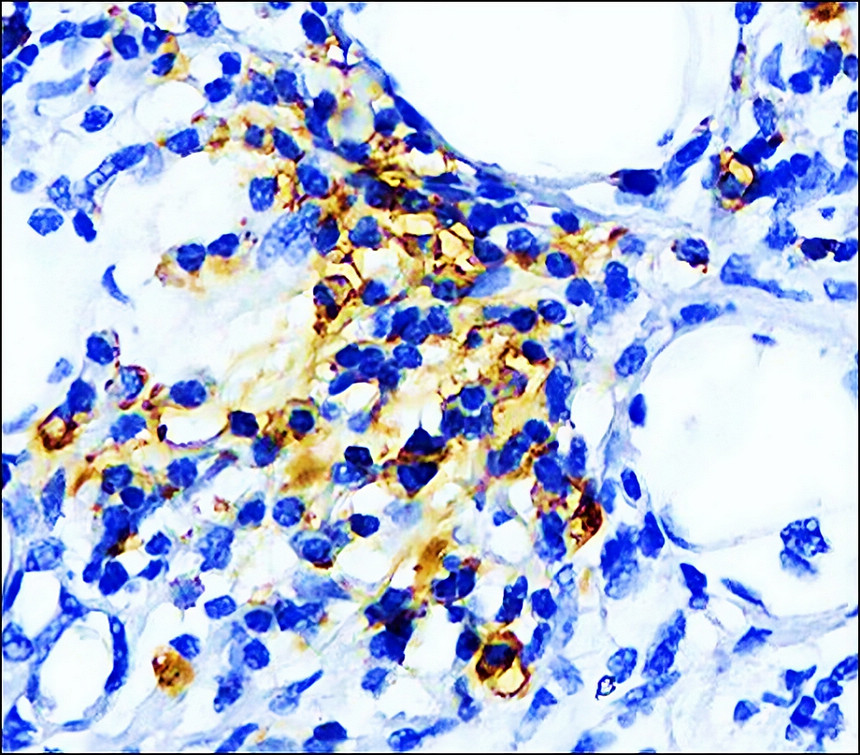 PD-L1 antibody 