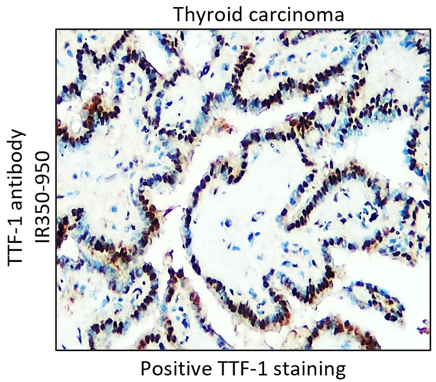 TTF-1 antibody 