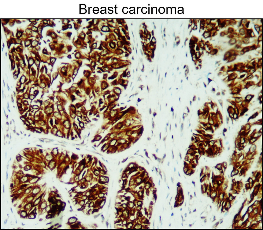 Cytokeratin 5/6, CK5/6 antibody