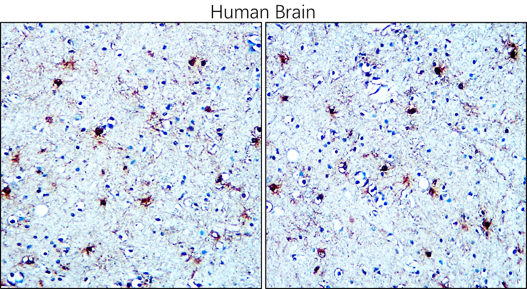  IR27-69 anti-S100B antibody IHC image