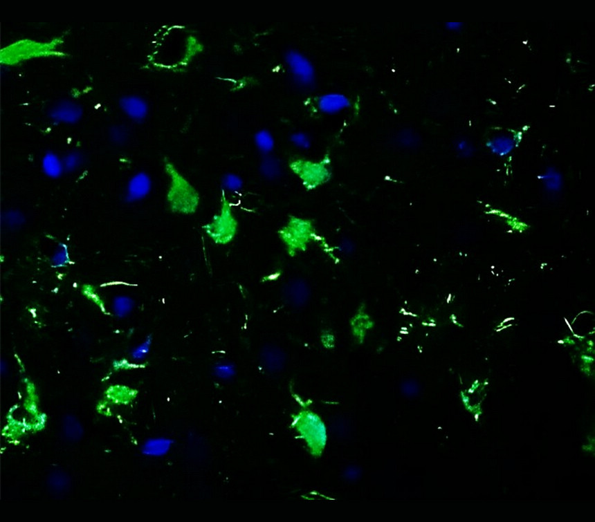 IR27-69 anti-S100B antibody IHC-Fr image