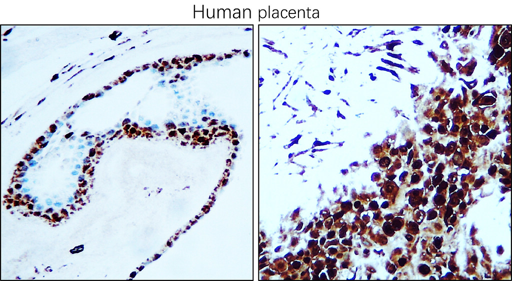 IR357-1 anti-PCNA antibody IHC image