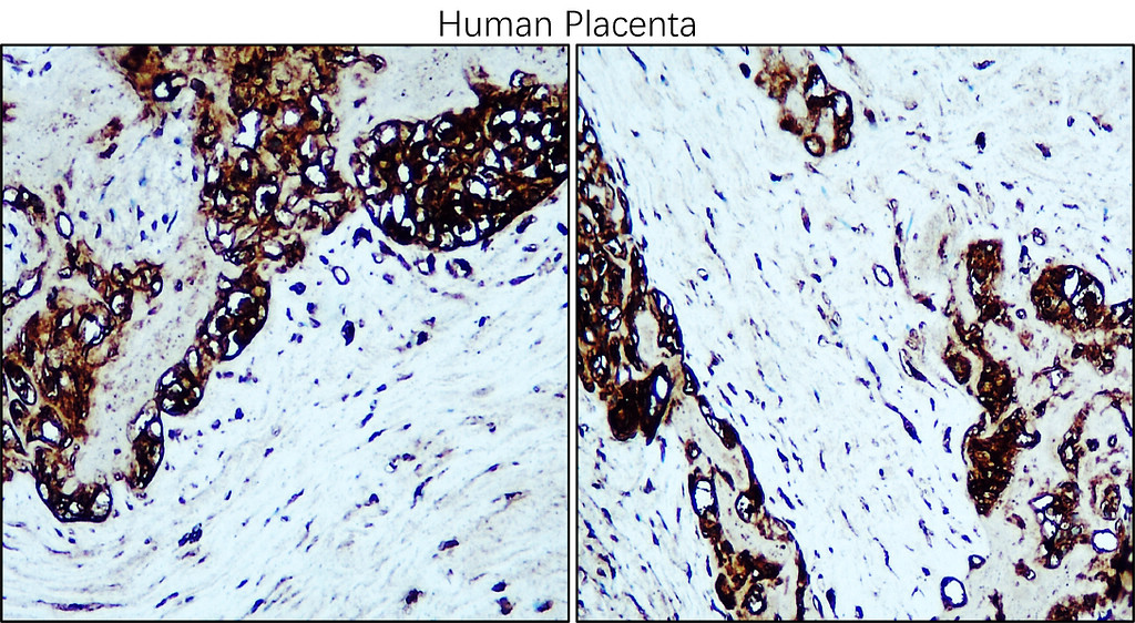 IRM216 Osteopontin / OPN antibody [C1H3] IHC Image