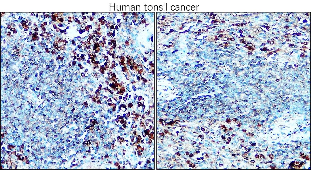 IRM316 CD25 / IL-2R alpha antibody [M431] IHC  Image