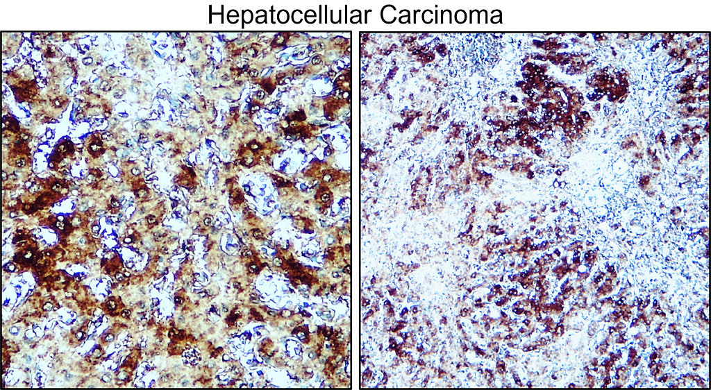  IRM311 Factor IX / F9 antibody [PB-3] IHC image 