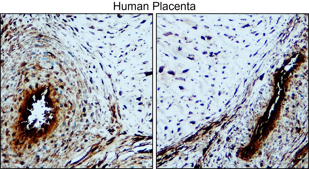  IRM311 Factor IX / F9 antibody [PB-3] IHC image 