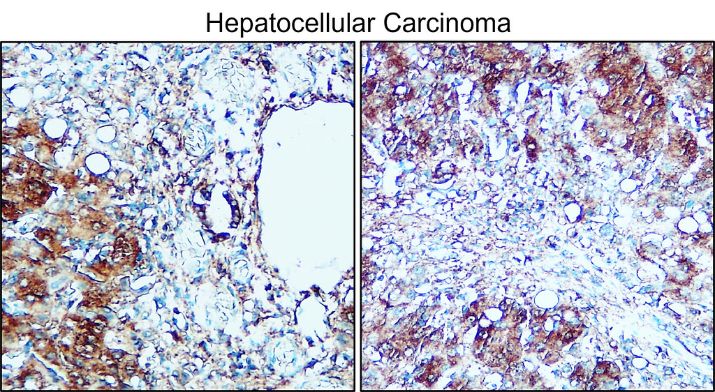 IRM314 TNF alpha antibody [PE-6] IHC image